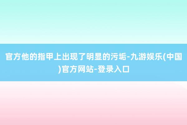 官方他的指甲上出现了明显的污垢-九游娱乐(中国)官方网站-登录入口